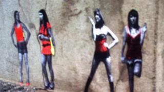 Διαπομπεύτηκε για το AIDS και αυτοκτόνησε...